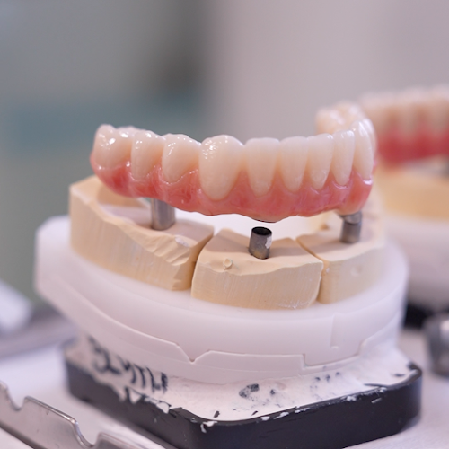 Dentalni rad i protetski model