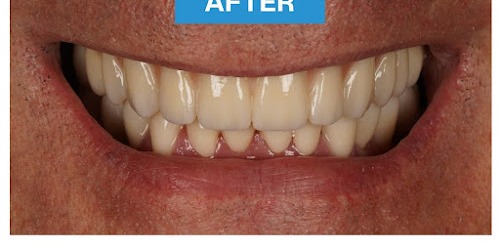 Dental Center Miletić primjer poslije zahvata