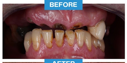 Dental Center Miletić primjer prije zahvata